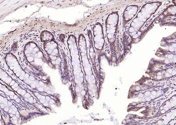 CREM Rabbit Polyclonal Antibody