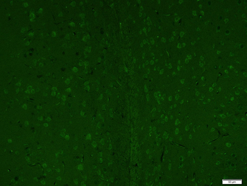 LC3A Mouse Monoclonal Antibody