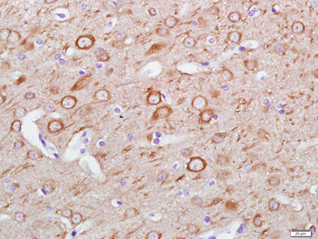 LC3A Mouse Monoclonal Antibody