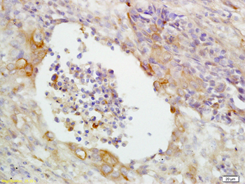 CD14 Rabbit Polyclonal Antibody
