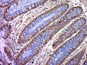 BTN2A1 Rabbit Polyclonal Antibody
