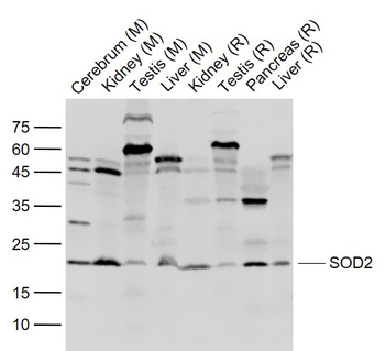 SOD2 Rabbit Polyclonal Antibody