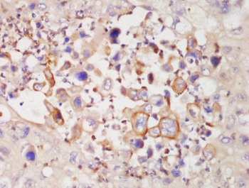 Desmocollin 1 Rabbit Polyclonal Antibody