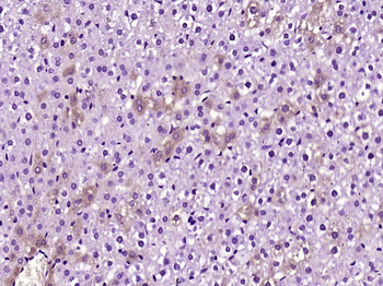 CAPN1 Rabbit Polyclonal Antibody