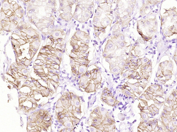 CA9 Mouse Monoclonal Antibody