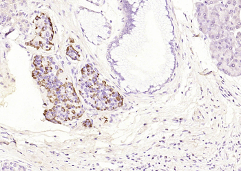 Bcl-2 Mouse Monoclonal Antibody