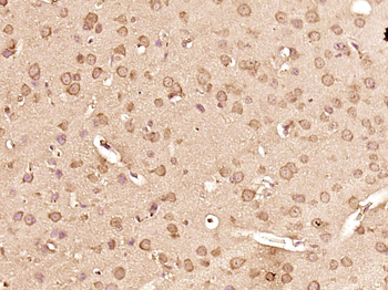 Smad3 Mouse Monoclonal Antibody