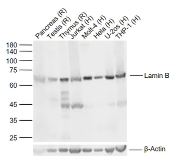 Lamin B1 Mouse Monoclonal Antibody (Nuclear Loading Control)