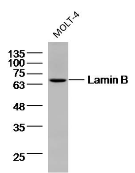 Lamin B1 Mouse Monoclonal Antibody (Nuclear Loading Control)