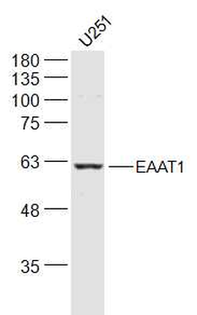 EAAT1 Rabbit Polyclonal Antibody