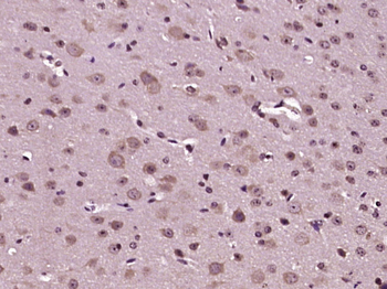 Semaphorin 3F Rabbit Polyclonal Antibody