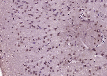 PKC alpha Rabbit Polyclonal Antibody