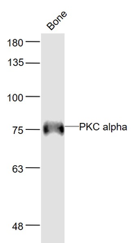 PKC alpha Rabbit Polyclonal Antibody