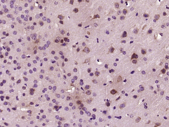 PKC alpha Rabbit Polyclonal Antibody
