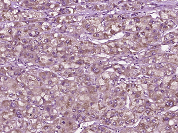 MERTK Rabbit Polyclonal Antibody