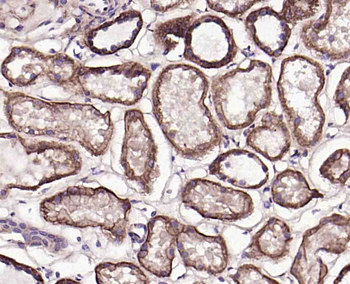 ABCB5 Mouse Monoclonal Antibody