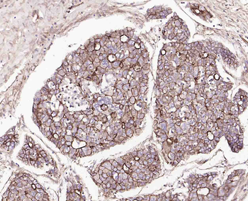 ABCB5 Mouse Monoclonal Antibody
