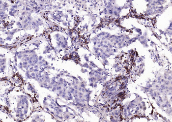 Phospho-PTEN (Ser380) Recombinant Rabbit Monoclonal Antibody