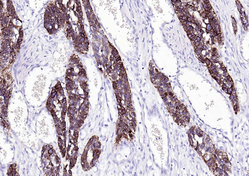 CK17 Mouse Monoclonal Antibody