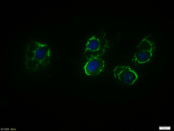 Beta catenin Rabbit Polyclonal Antibody