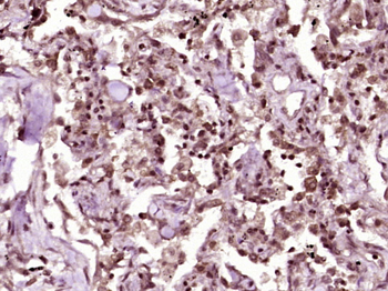 Beta catenin Rabbit Polyclonal Antibody