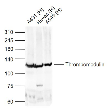 Thrombomodulin Rabbit Polyclonal Antibody