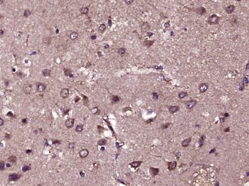 FGF2 Rabbit Polyclonal Antibody