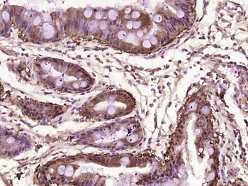 LFABP/FABP-1 Rabbit Polyclonal Antibody