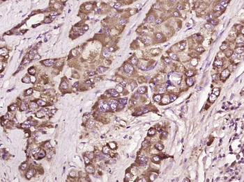 LFABP/FABP-1 Rabbit Polyclonal Antibody