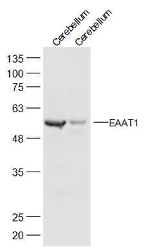 EAAT1 Rabbit Polyclonal Antibody