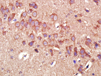 MMP2 Mouse Monoclonal Antibody