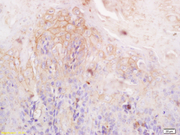 Filaggrin Rabbit Polyclonal Antibody