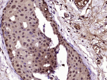 Progesterone Receptor Rabbit Polyclonal Antibody