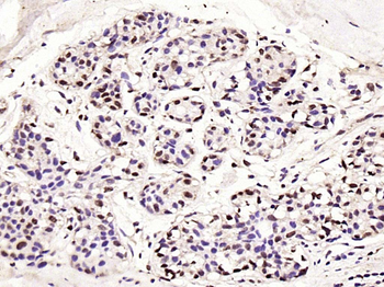 P53 (Mono Methyl Lys370) Mouse Monoclonal Antibody