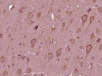 TMEM85 Rabbit Polyclonal Antibody
