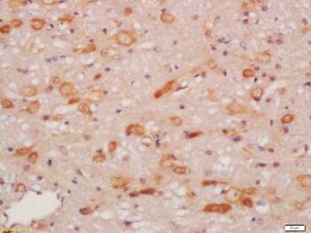 HRG1 Rabbit Polyclonal Antibody
