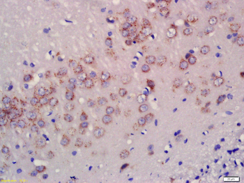 HRG1 Rabbit Polyclonal Antibody
