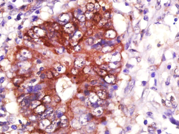 HSP90 alpha Mouse Monoclonal Antibody