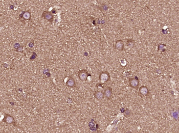 Active Caspase 3 Mouse mAb