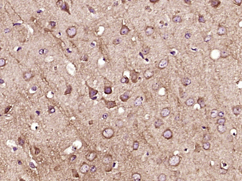 Active Caspase 3 Mouse mAb