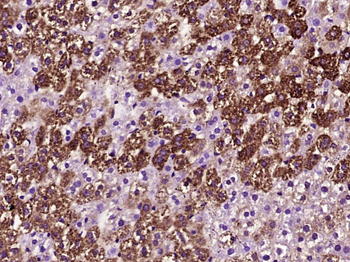 Active Caspase 3 Mouse mAb