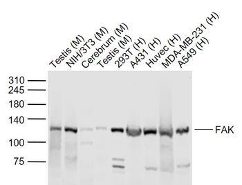 FAK Rabbit Polyclonal Antibody