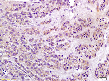 Notch1 Rabbit Polyclonal Antibody
