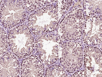 Beta catenin Rabbit Polyclonal Antibody