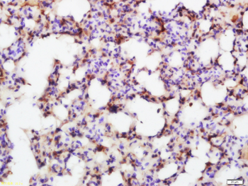 SMAD7 Rabbit Polyclonal Antibody