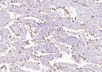 Cytokeratin 8 Mouse Monoclonal Antibody