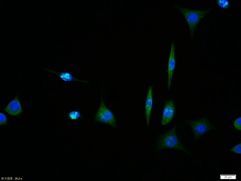 GPR30 Rabbit Polyclonal Antibody