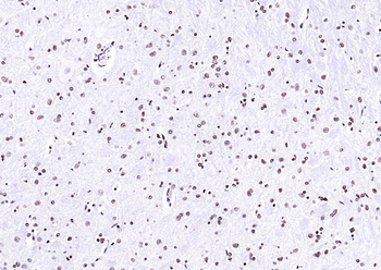 Histone H3 Mouse Monoclonal Antibody (Nuclear Loading Control)