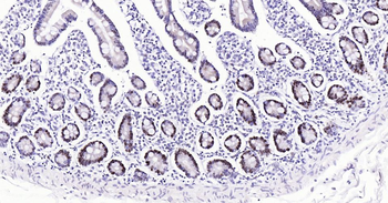 PCNA Mouse Monoclonal Antibody (Nuclear Loading Control)