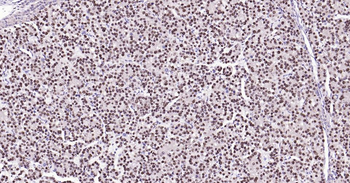 PCNA Mouse Monoclonal Antibody (Nuclear Loading Control)